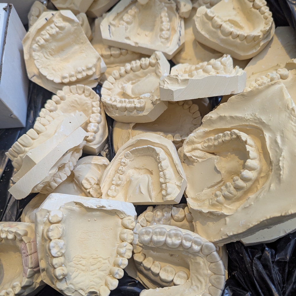 Dental Molds Decorative Collection